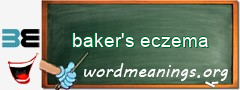 WordMeaning blackboard for baker's eczema